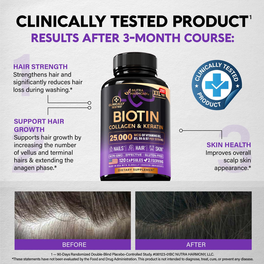NutraHarmony B-complex graphic shows Biotin 25,000 mcg per serving.