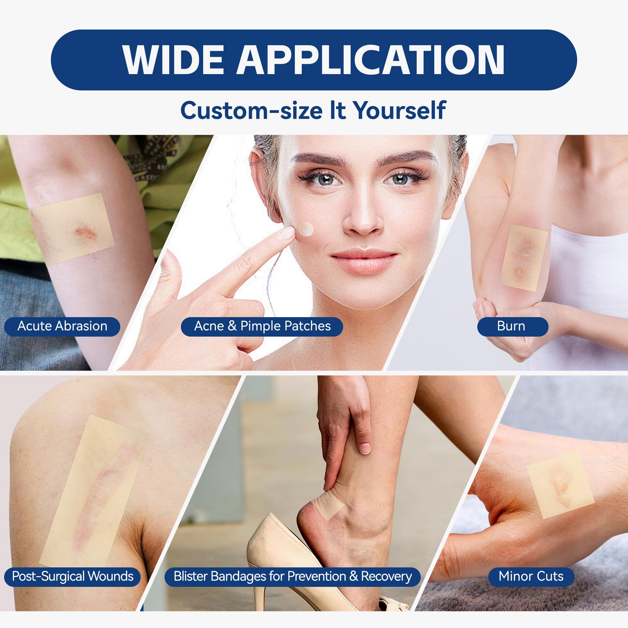 Nutritiontree waterproof hydrocolloid dressings protect wounds from moisture