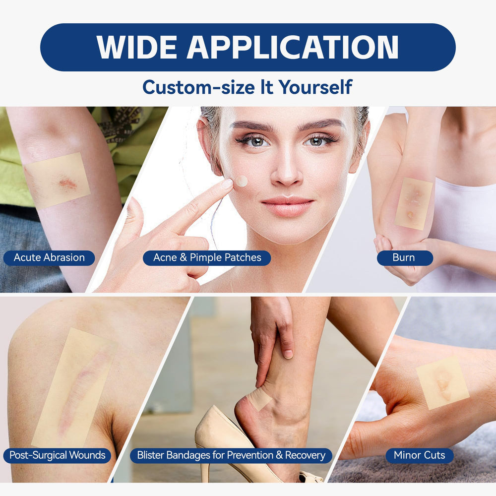 Nutritiontree waterproof hydrocolloid dressings protect wounds from moisture