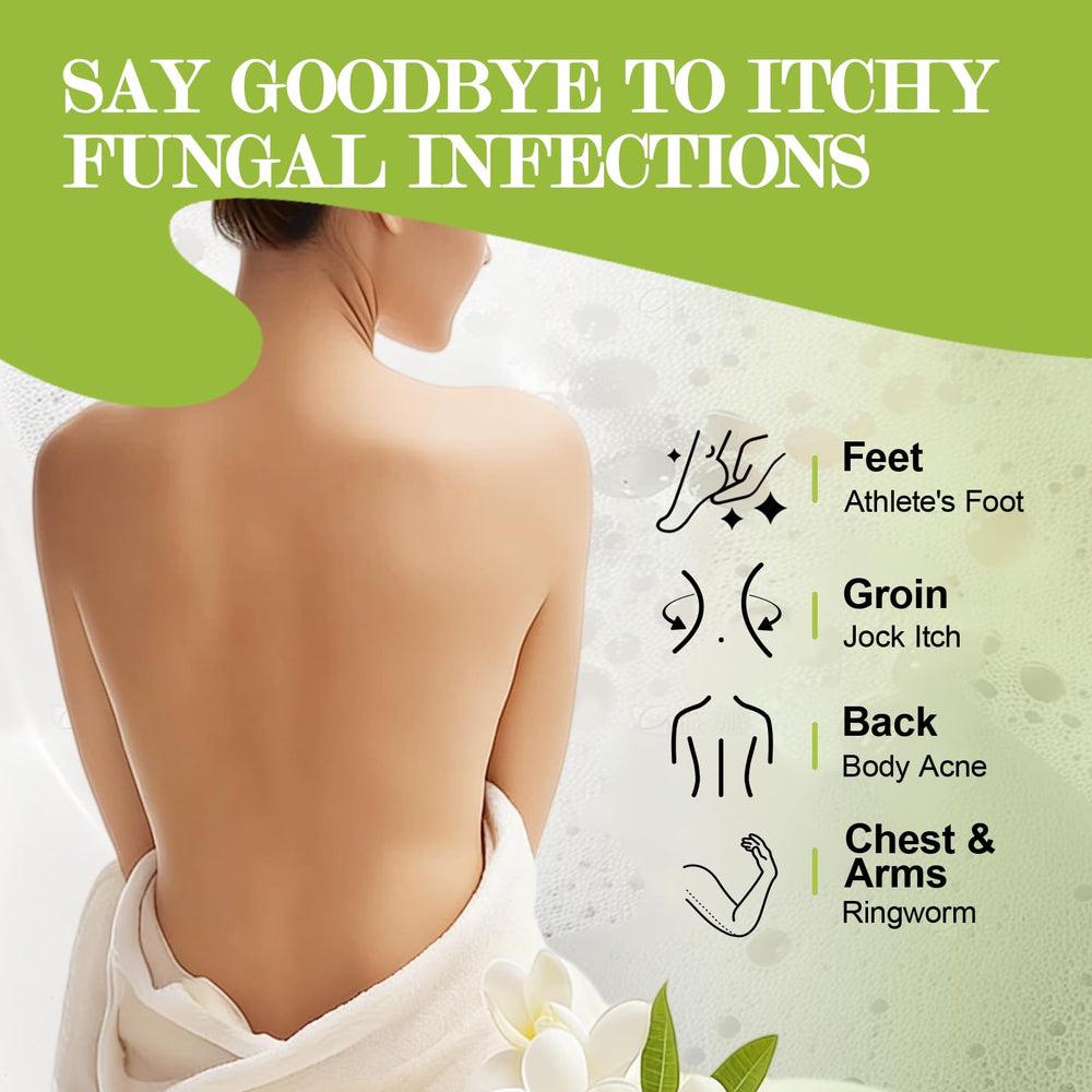 NXPPYY antifungal soap used on feet for itching relief