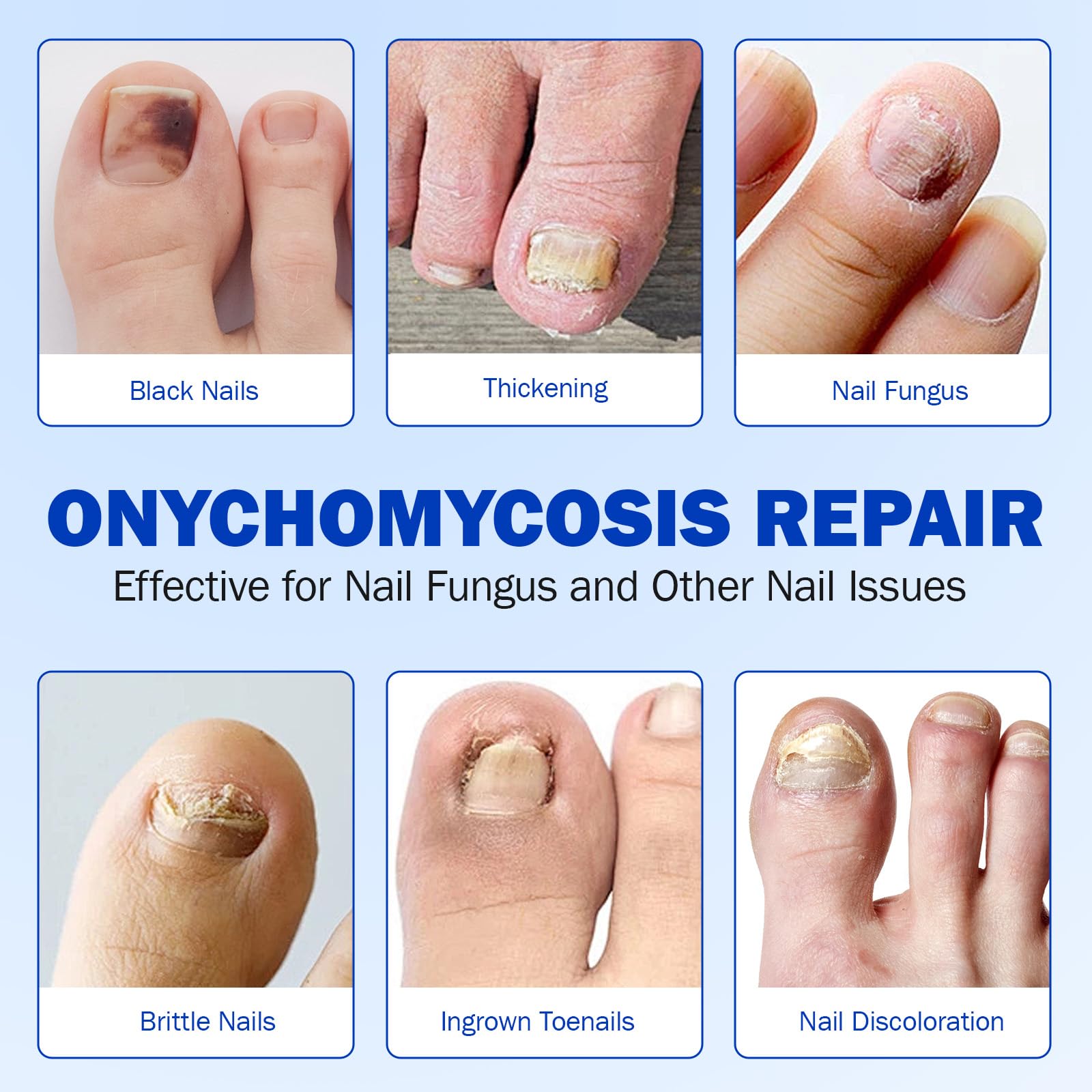 Nyloriaine nail patches brighten nail appearance while staying gentle.