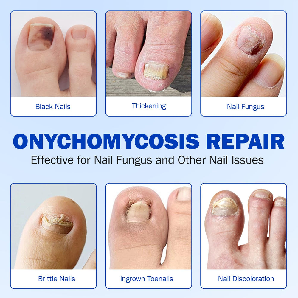 Nyloriaine nail patches brighten nail appearance while staying gentle.