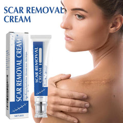 NYYQYYN Silicone Scar Gel bottle showing quick-drying, breathable film for comfortable scar care.