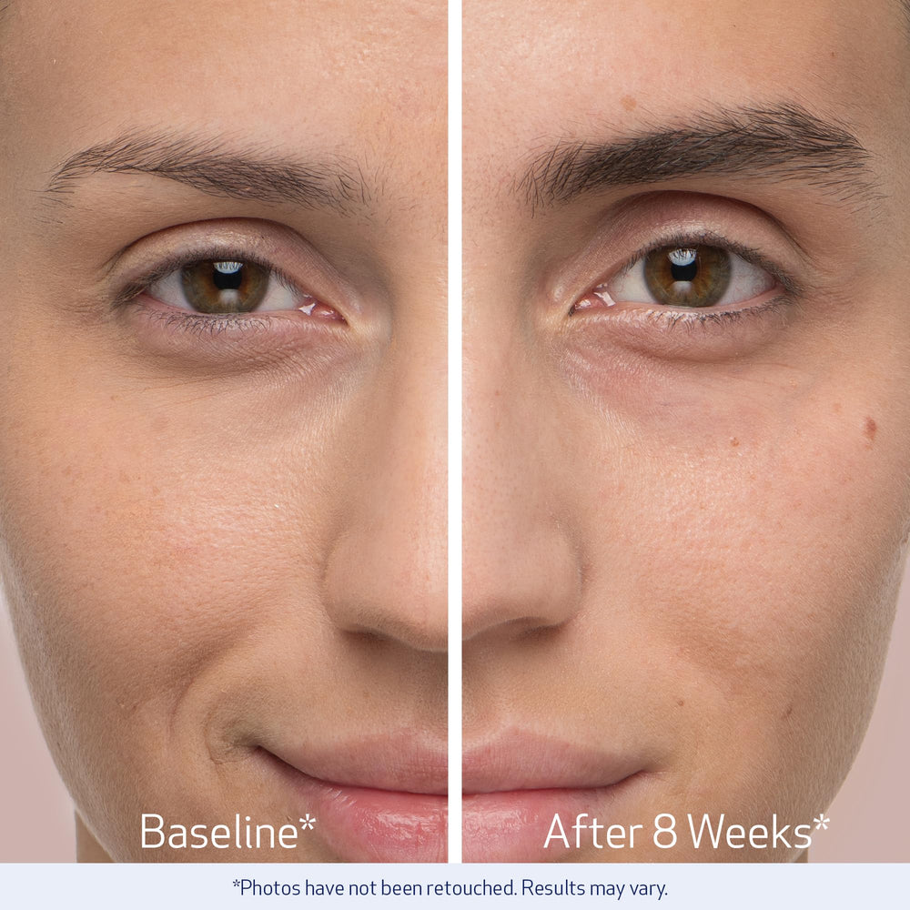 Obagi Nu-Cil before-after brow comparison shows density improvements.