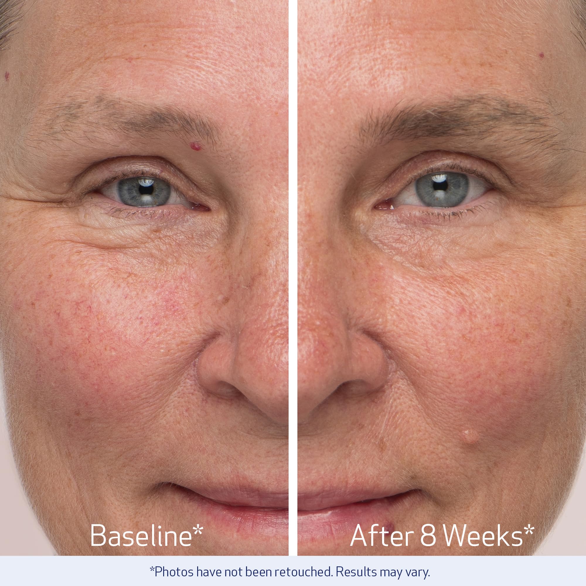 Obagi Nu-Cil serum texture closeup highlights lightweight formula.