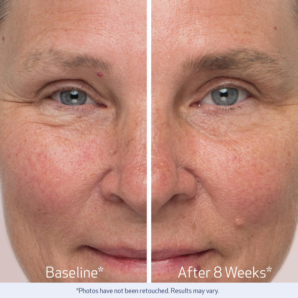 Obagi Nu-Cil serum texture closeup highlights lightweight formula.