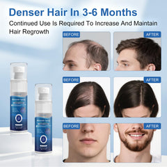OCVWJKD beard-growth application indicates potential for fuller facial hair.