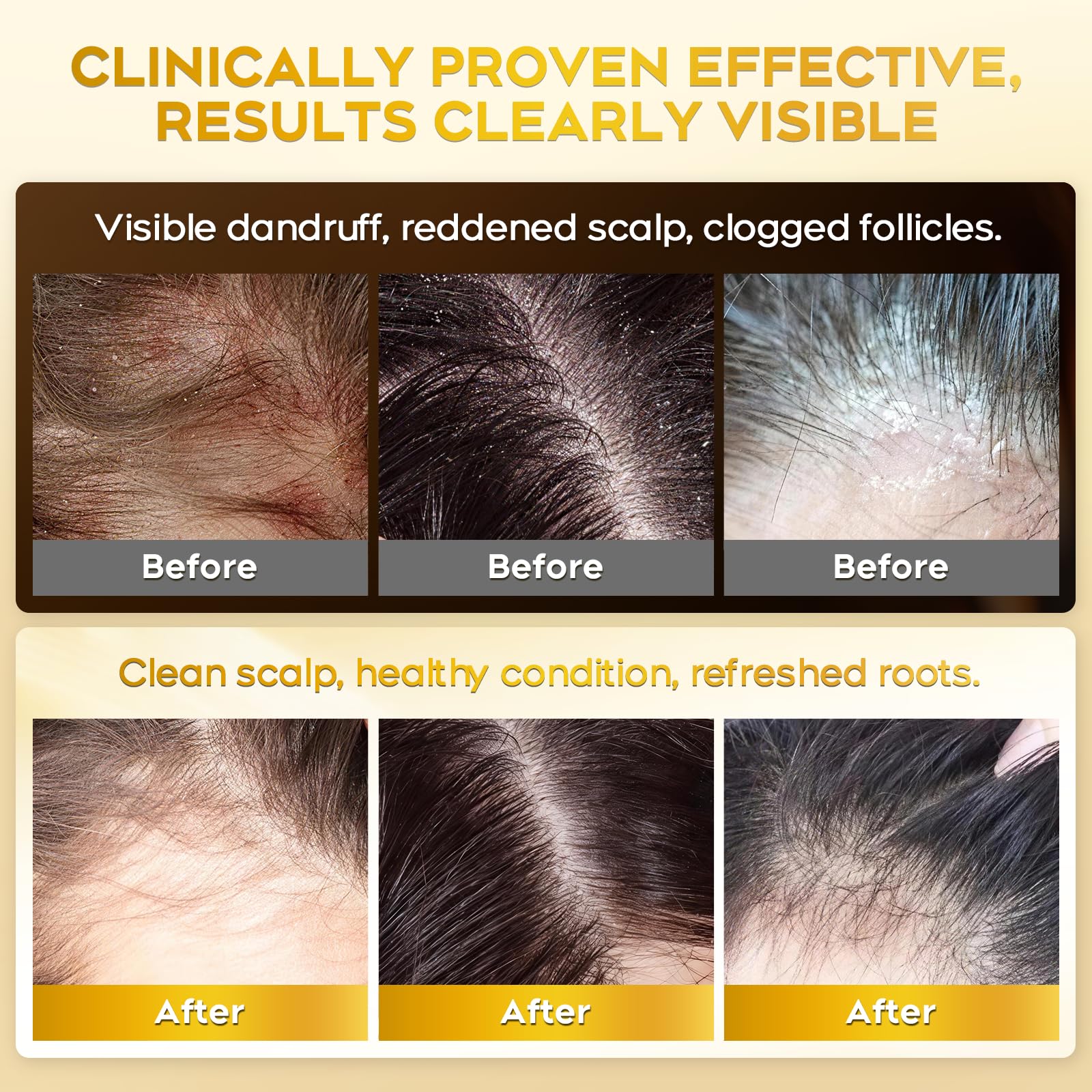 oely Enhanced Antifungal Shampoo bottle with brand tag signals trusted scalp care.