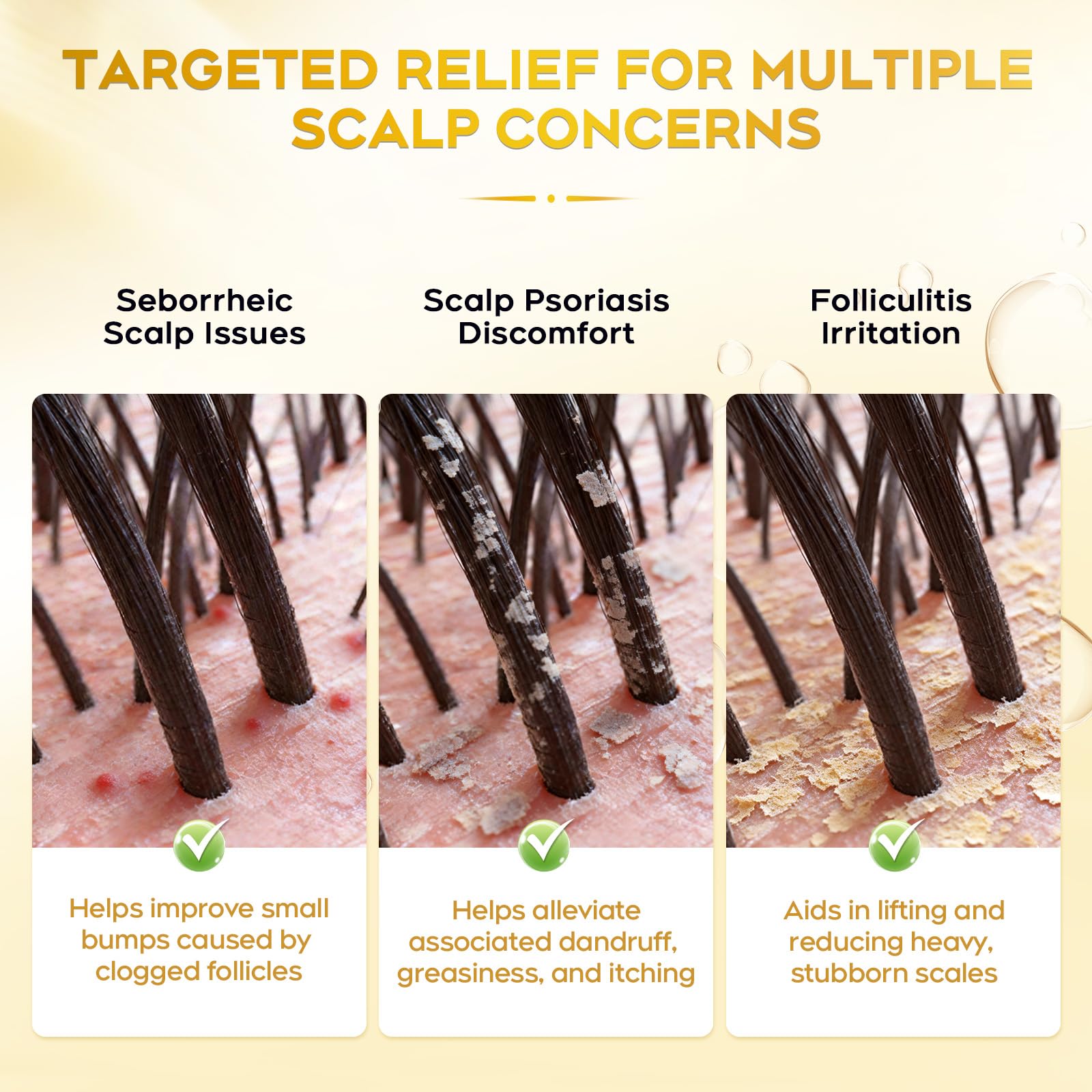 oely Enhanced Antifungal Shampoo label details highlight dermatologist-friendly ingredients and daily-use suitability.