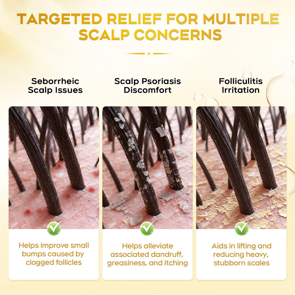 oely Enhanced Antifungal Shampoo label details highlight dermatologist-friendly ingredients and daily-use suitability.
