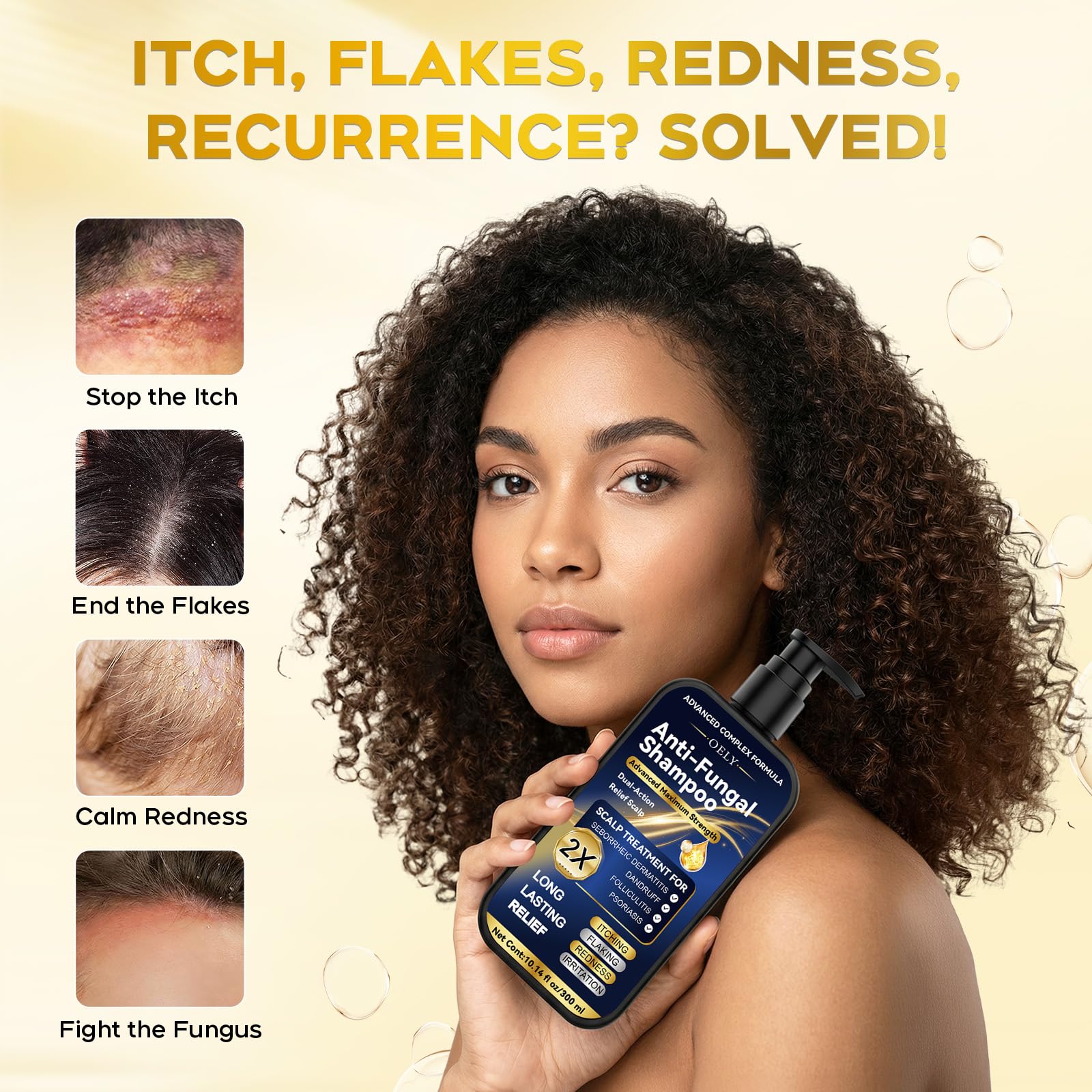 oely Enhanced Antifungal Shampoo lather in hands highlights quick scalp relief.