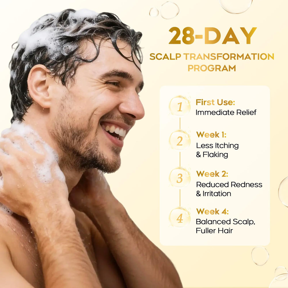 oely Enhanced Antifungal Shampoo packaging view emphasizes sulfate-free formula for sensitive hair.