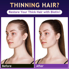 Oely rosemary extract scalp image highlights oil balance and fresh roots.