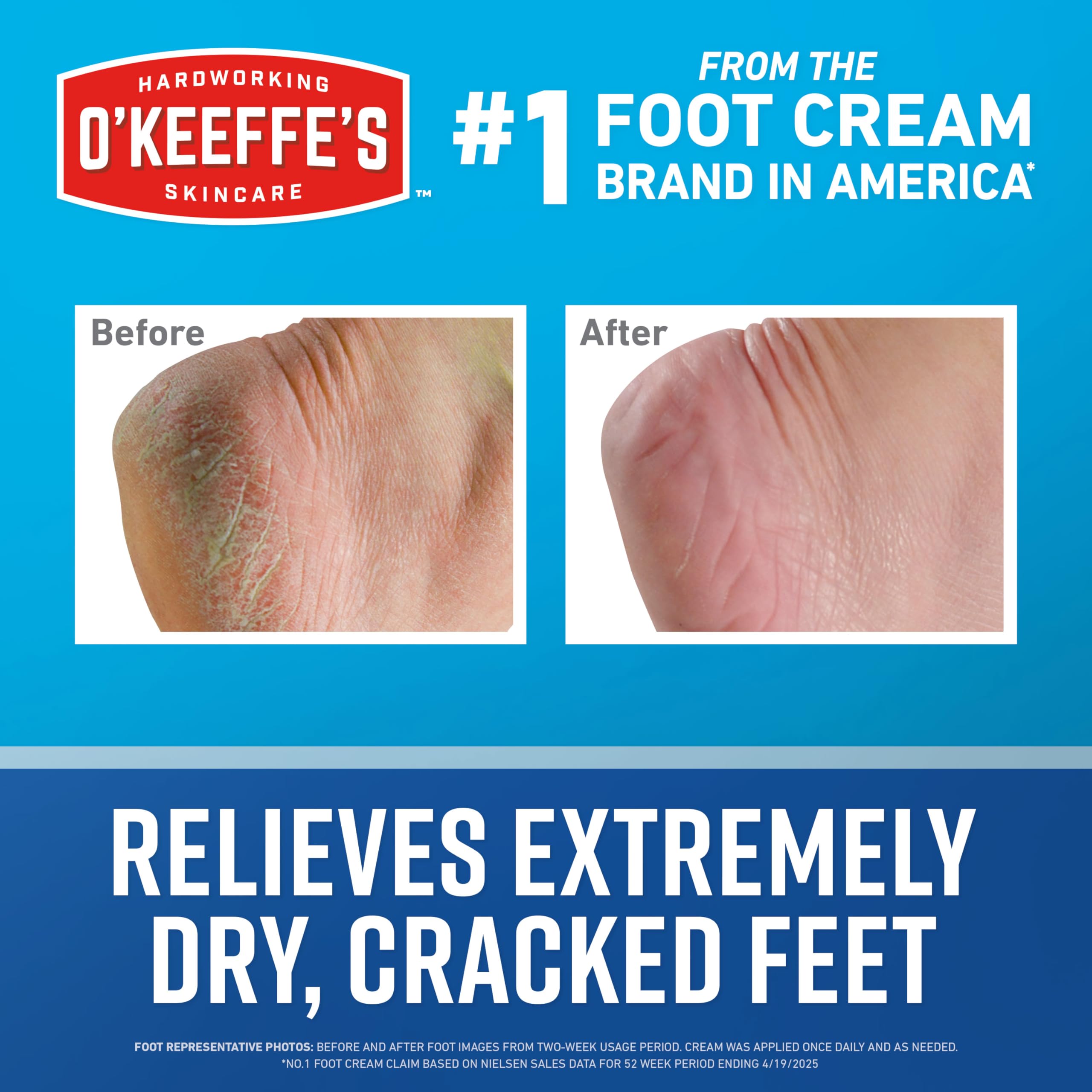 O'Keeffe's Healthy Feet applying cream on feet for dry skin relief.