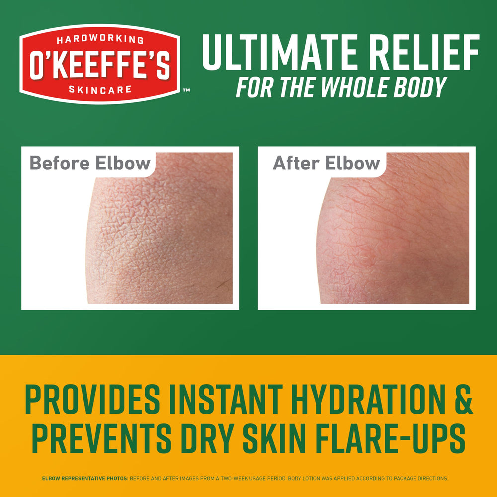 O'Keeffe's Skin Repair Ultimate Relief on hand shows rapid relief after use.