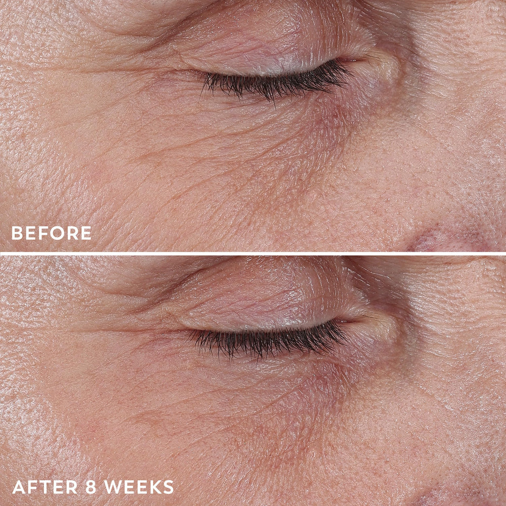Olay Regenerist eye care roller delivering instant hydration around the eye area