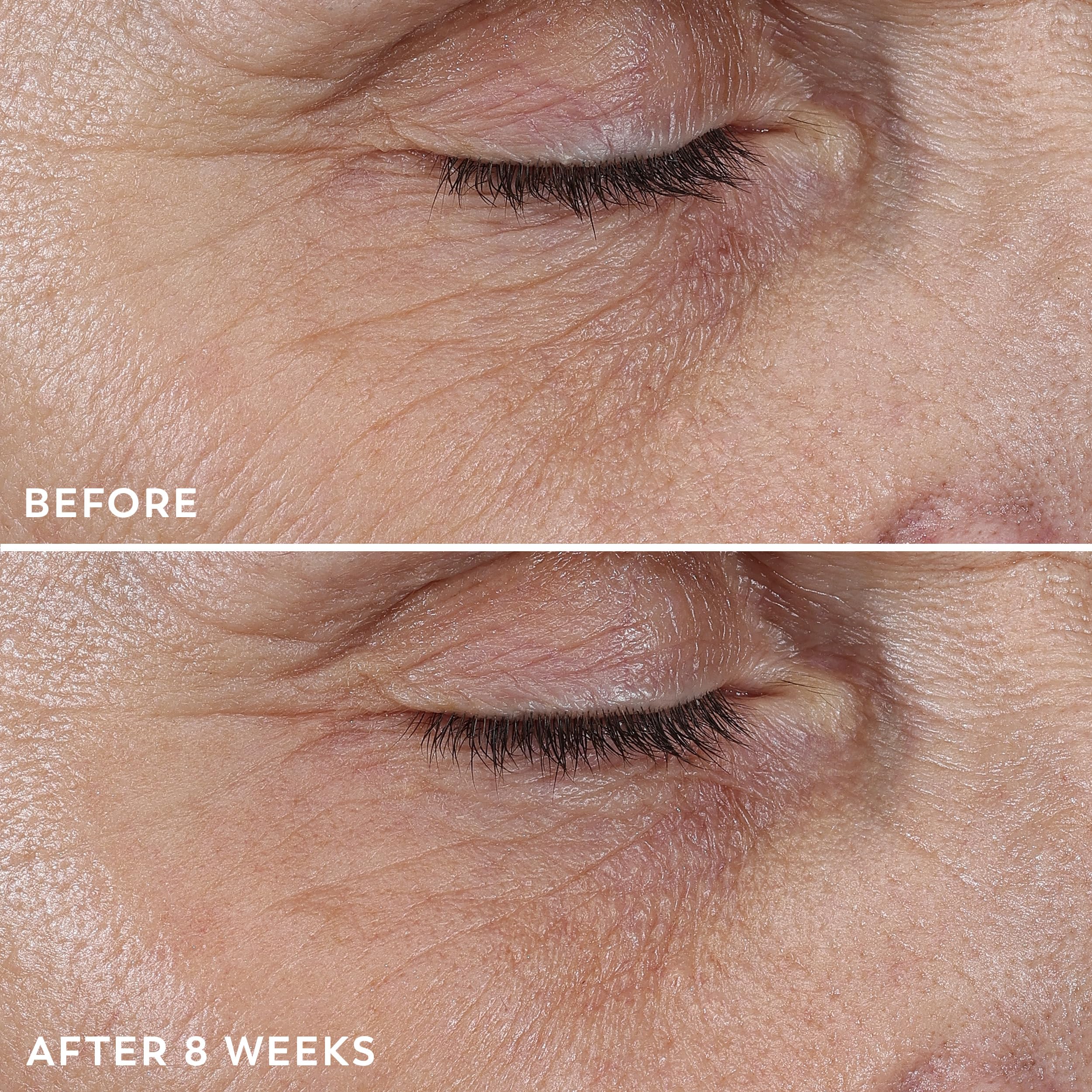 Olay Regenerist skin-firming action graphic emphasizes elasticity