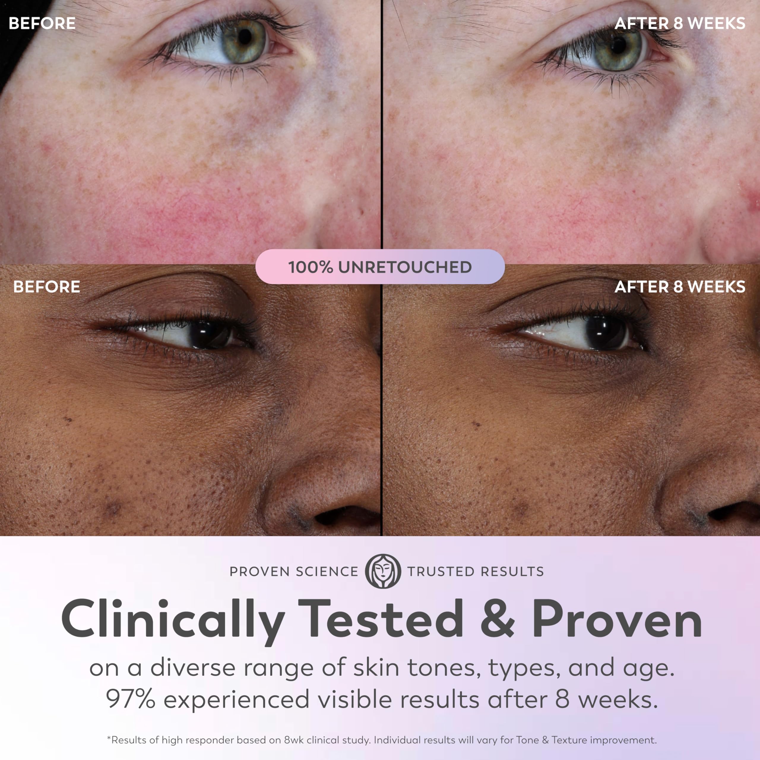 Olay Super Serum niacinamide ingredient highlights refined texture and even tone