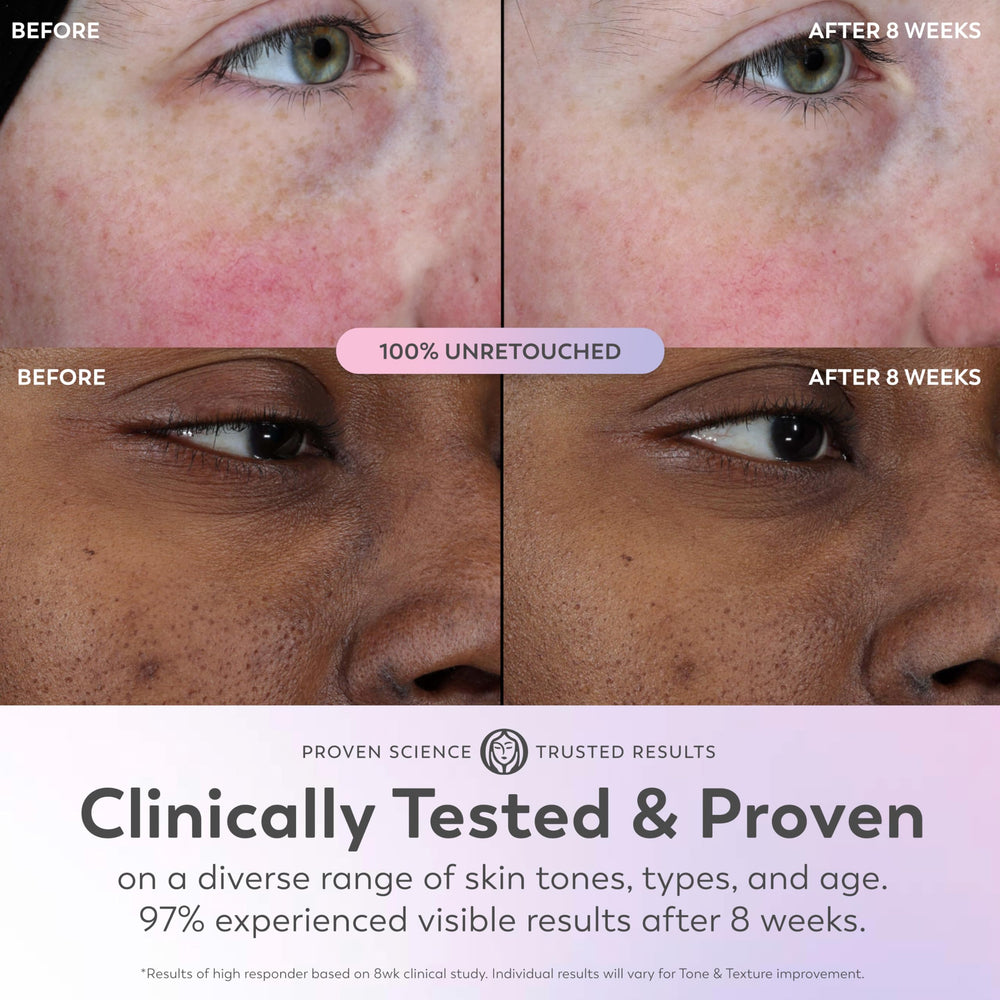 Olay Super Serum niacinamide ingredient highlights refined texture and even tone