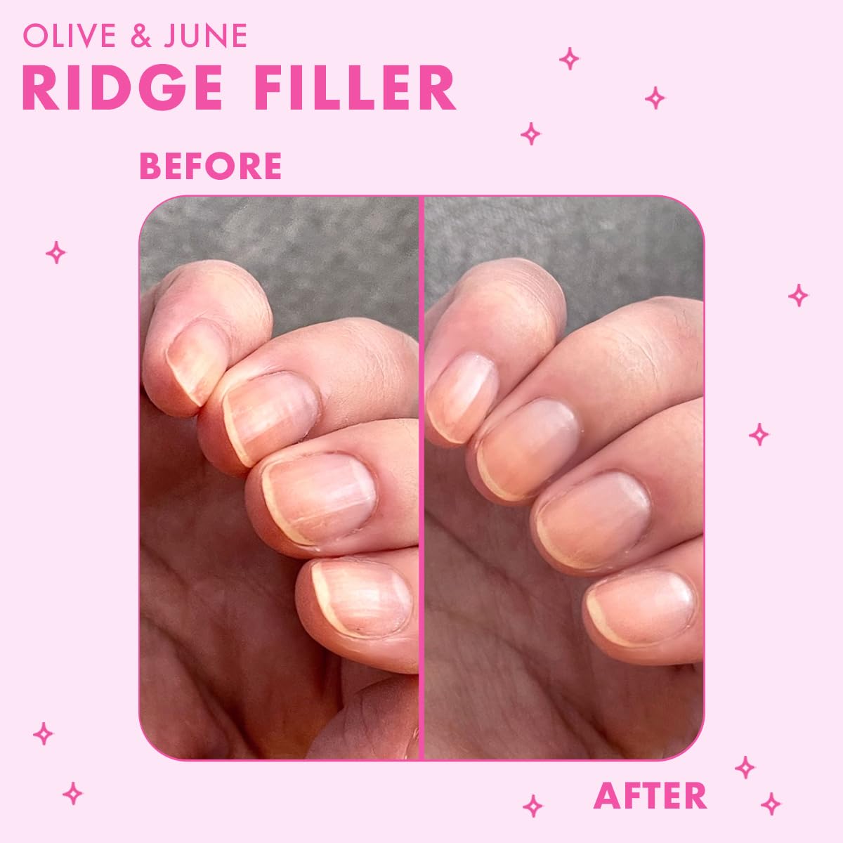Bare nails before Ridge Filler showing ridges and uneven texture.