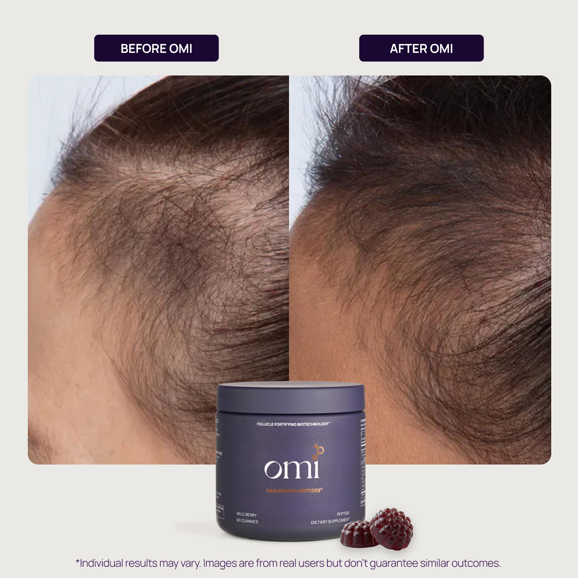 Gummies on a surface depict a simple daily habit for hair health with OMI.