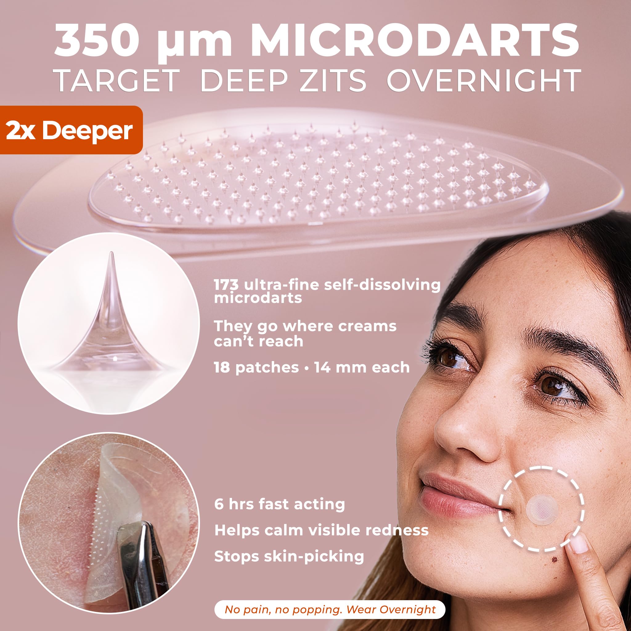 OMMA patch on skin during overnight use for early-stage zits