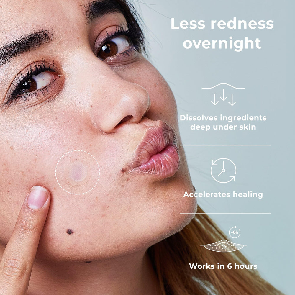OMMA zit stickers pack displayed for acne care