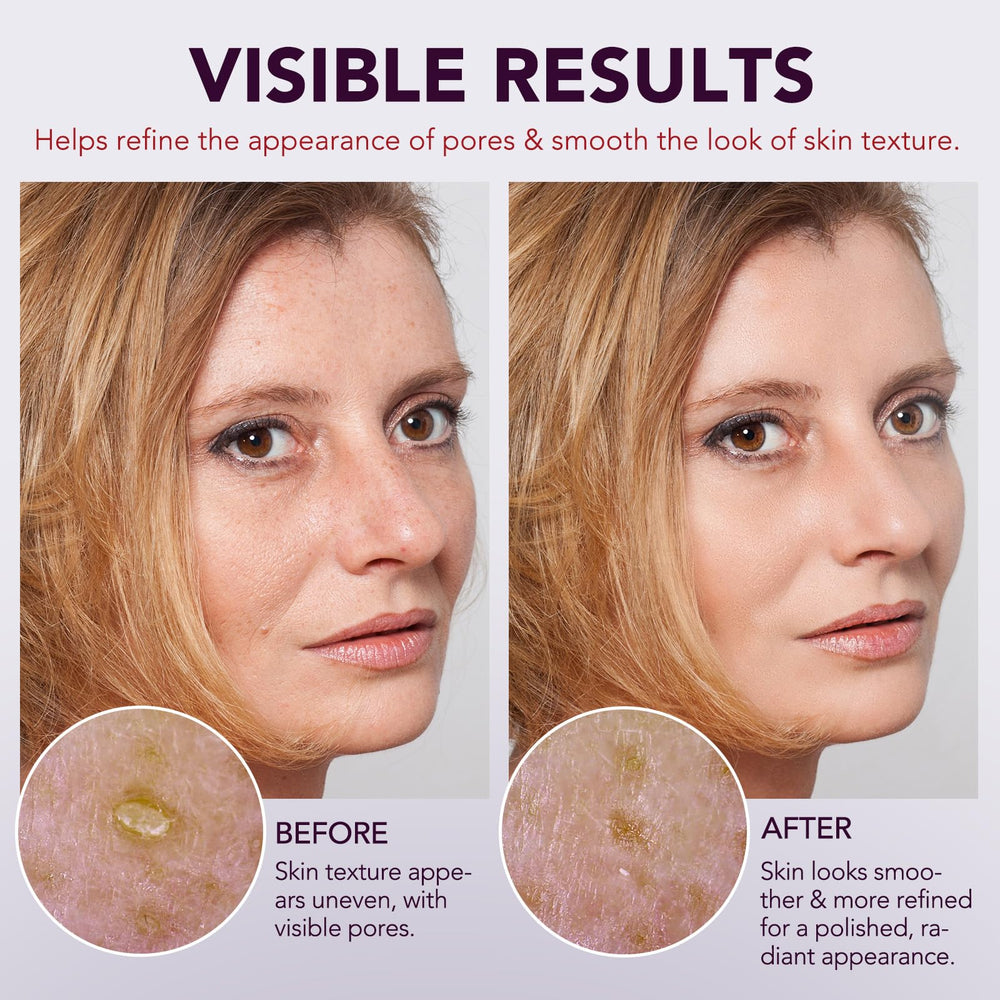OMZOK Rice Extract Anti-Aging Serum vial nourishes and protects skin texture.
