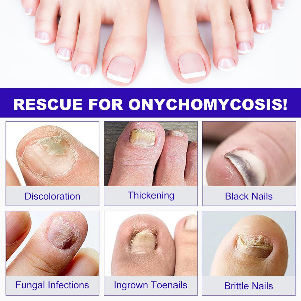 Before and after style illustration suggests potential nail improvement.