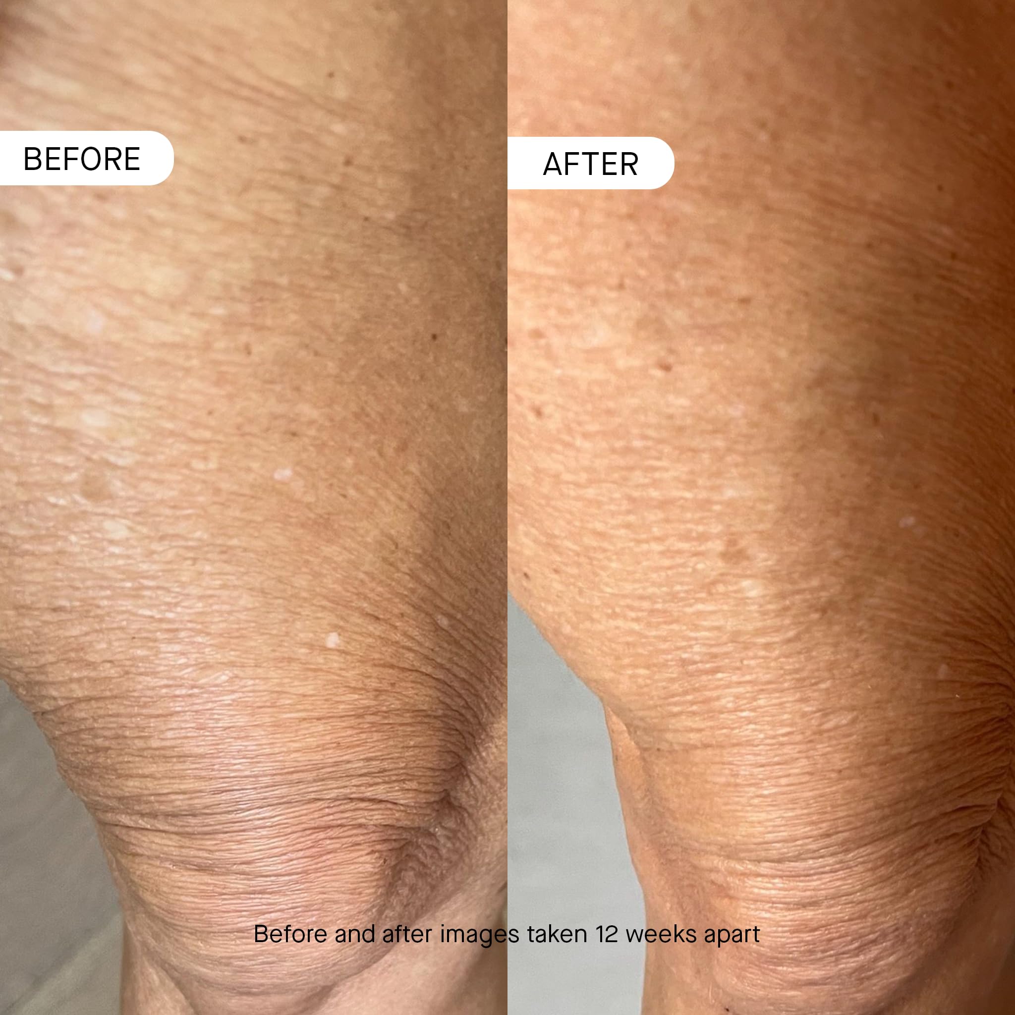 oneskin BODY OS-01 peptide application on arm; easy daily use.
