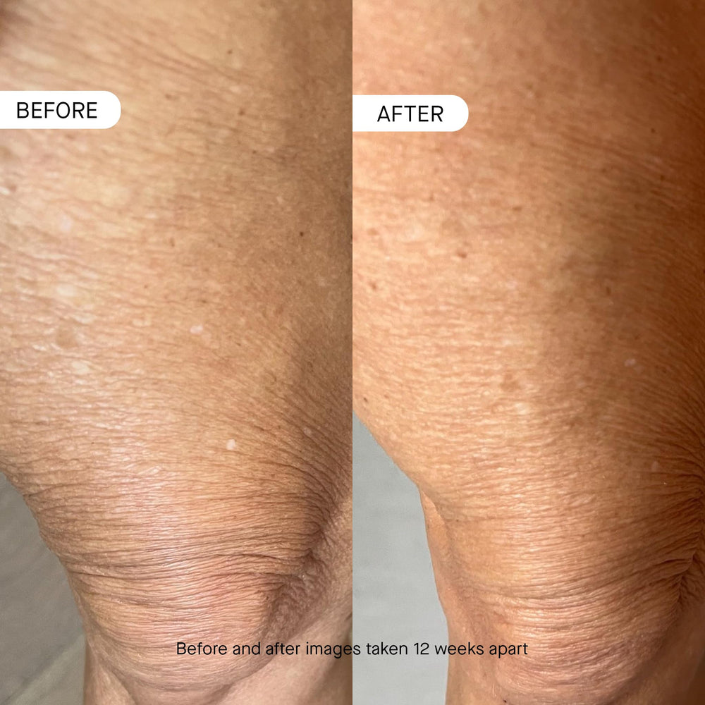 oneskin BODY OS-01 peptide application on arm; easy daily use.
