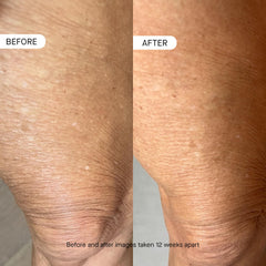 oneskin BODY OS-01 peptide application on arm; easy daily use.