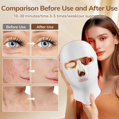 ONLUKY red light mask with neck attachment for wider treatment reach