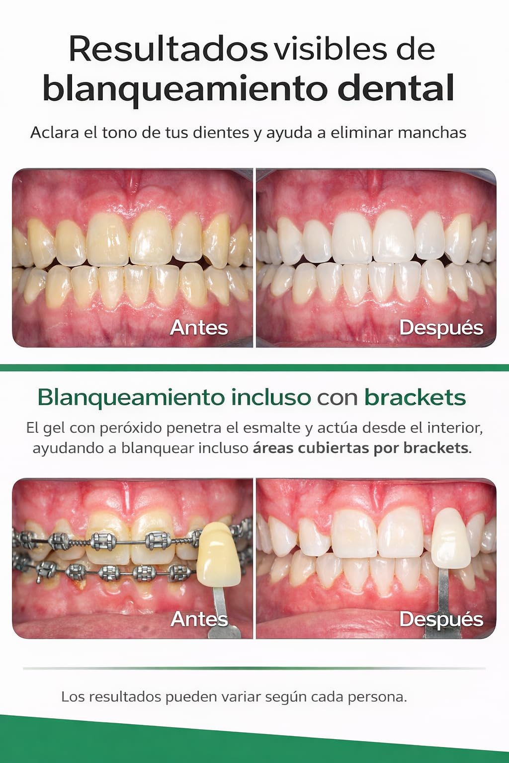 Kit packaging featuring prefilled trays and gel strips.