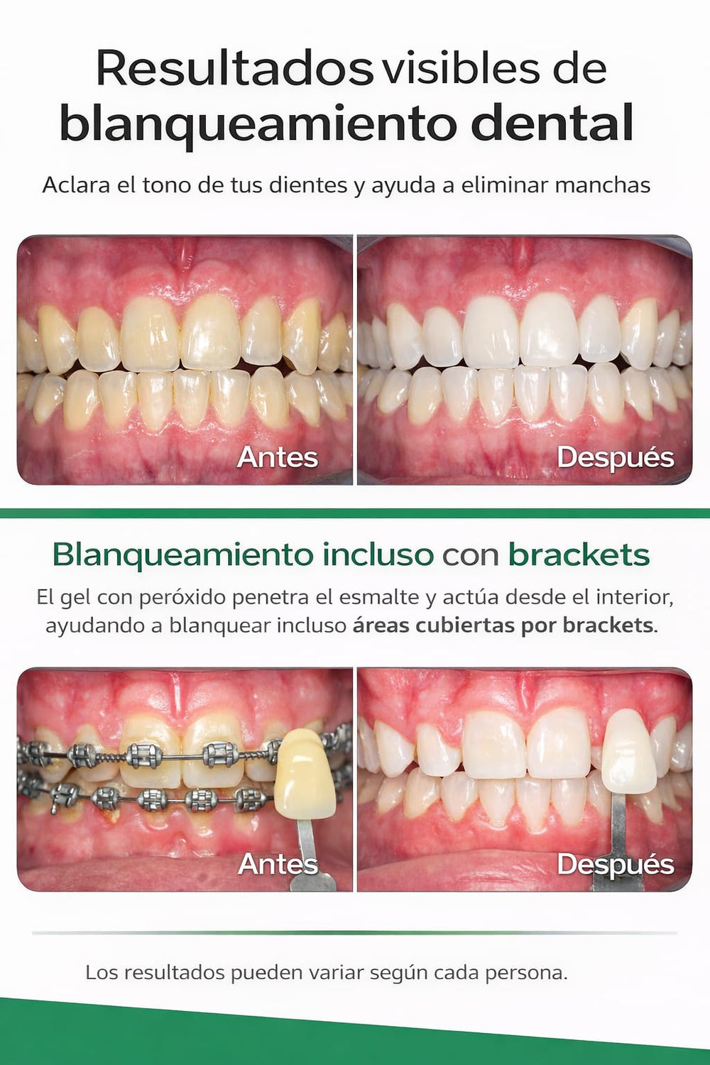 Kit packaging featuring prefilled trays and gel strips.