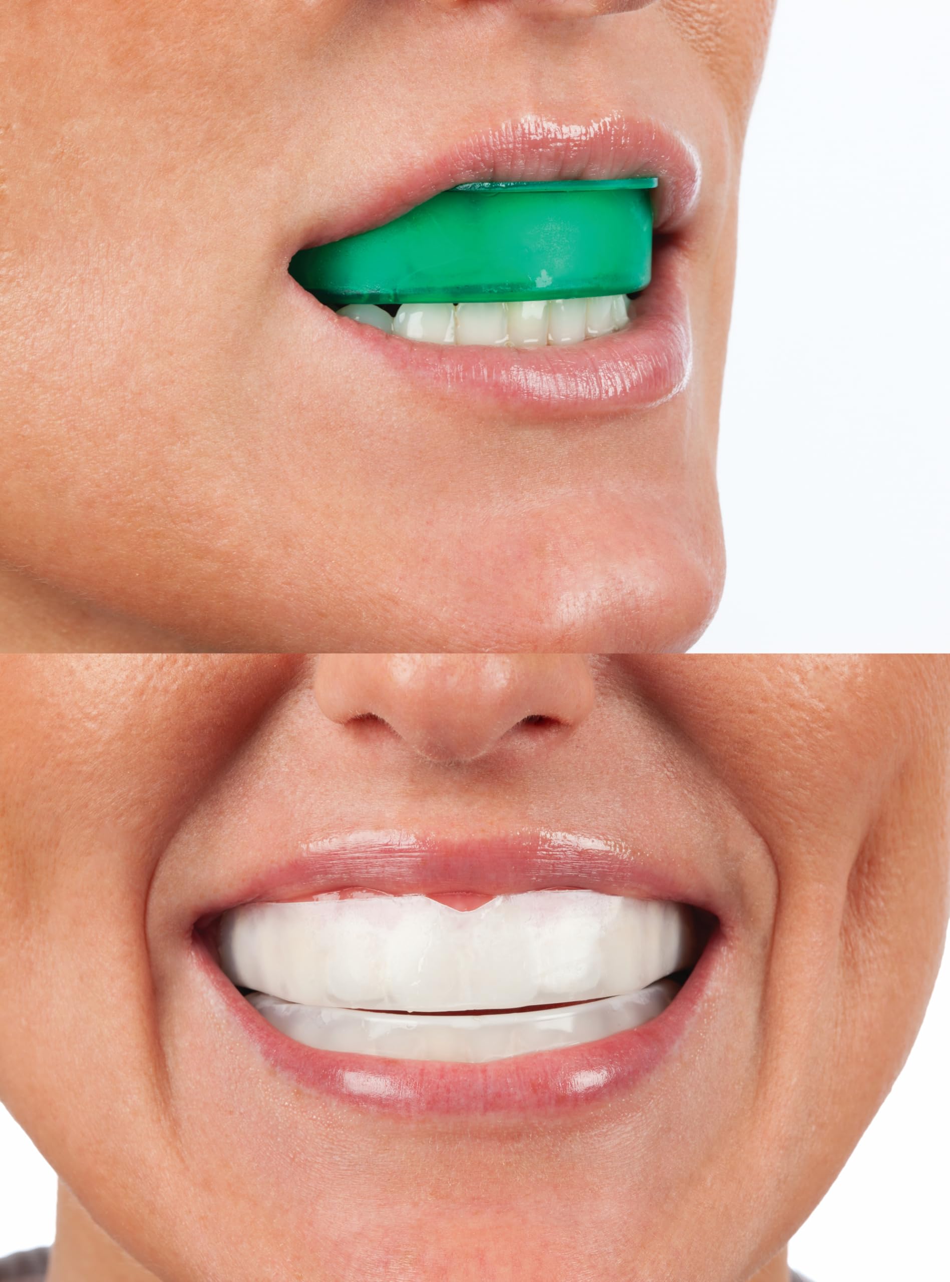 Opalescence Go compact kit beside travel pouch, ideal for on-the-go whitening.