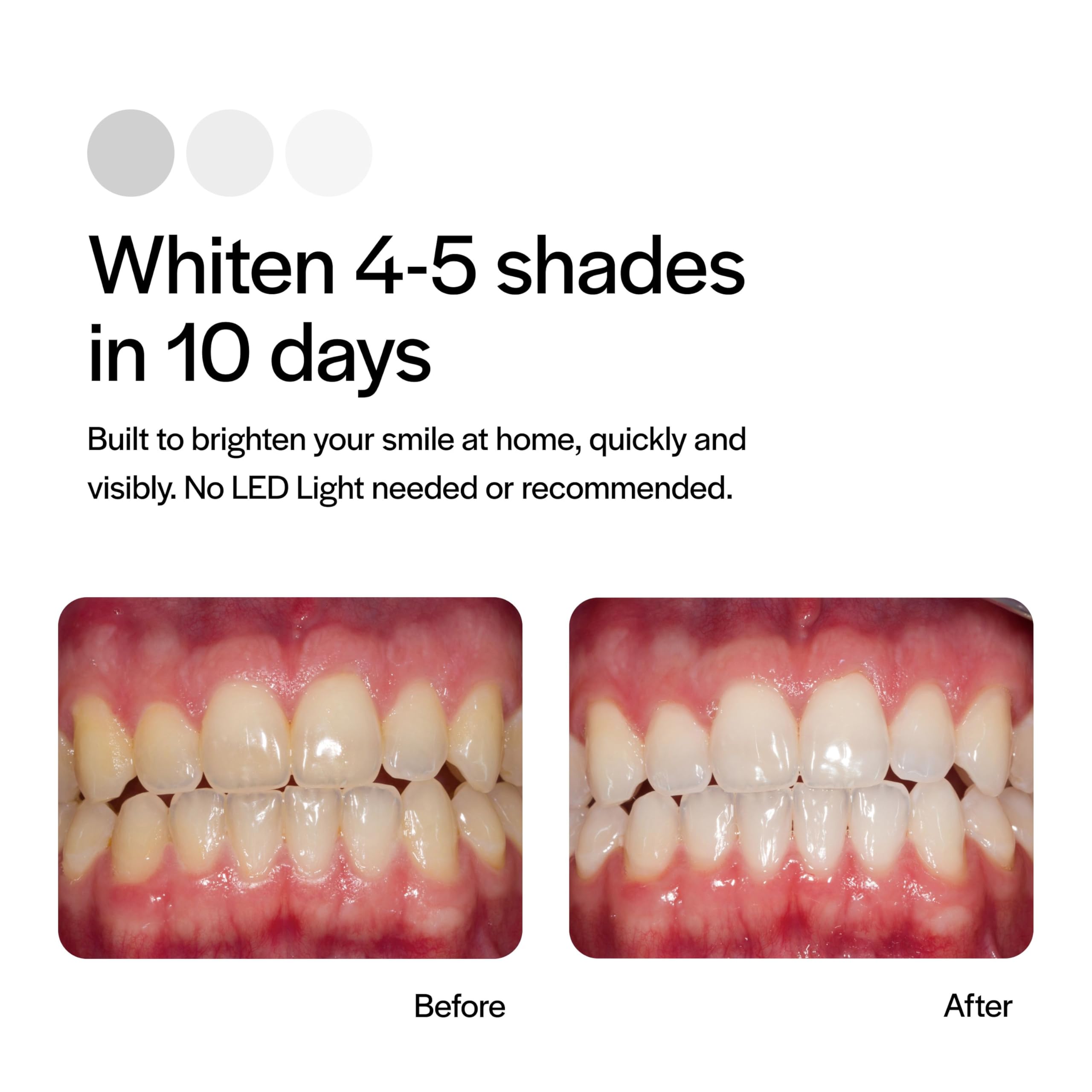 Opalescence GO trays with inside gel strips for even whitening action.