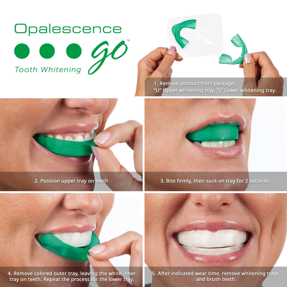 Opalescence GO trays with gel strips illustrate easy, mess-free whitening.