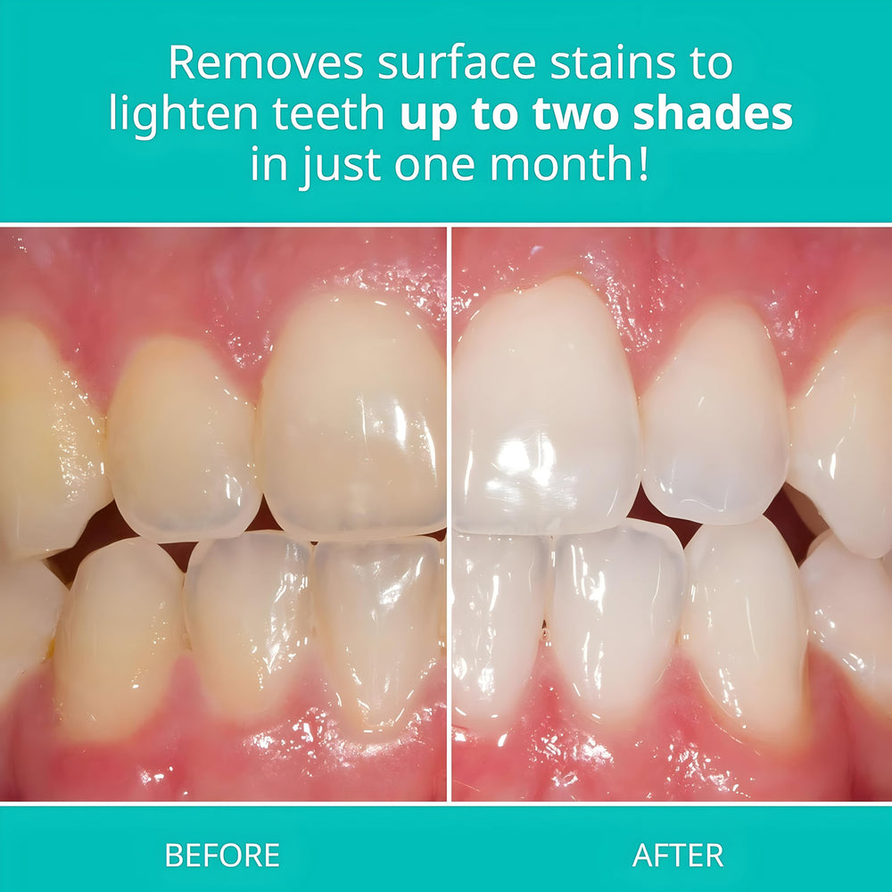 Opalescence toothpaste Cool Mint brushing session conveys refreshing breath after brushing