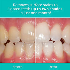 Opalescence toothpaste Cool Mint brushing session conveys refreshing breath after brushing