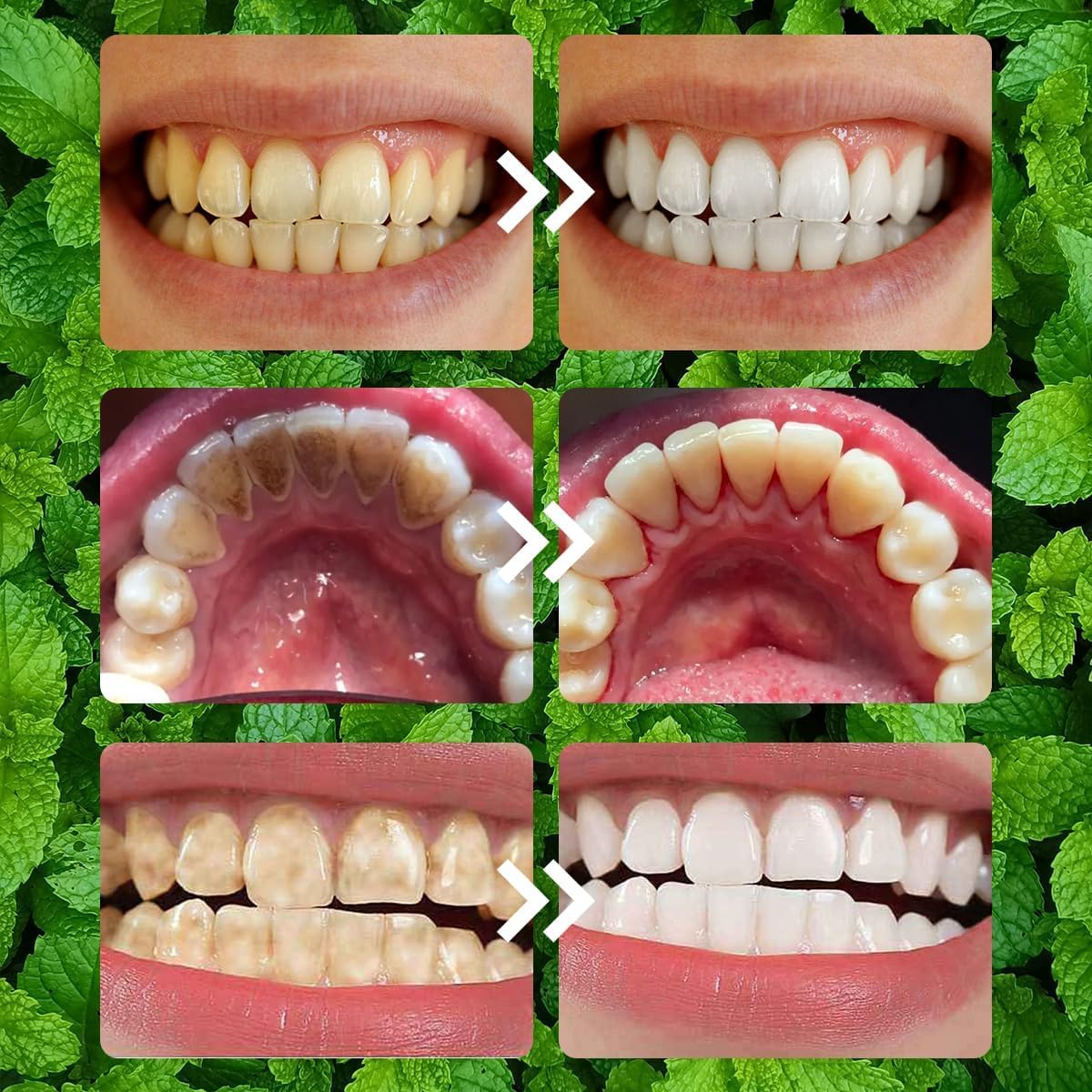 Oprtuisi Fresh mouth feel after use during daily routines.