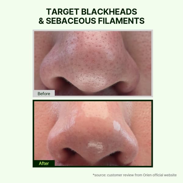 Orien Mugwort Zero Film Cleansing Oil applied on face demonstrates gentle cleansing.