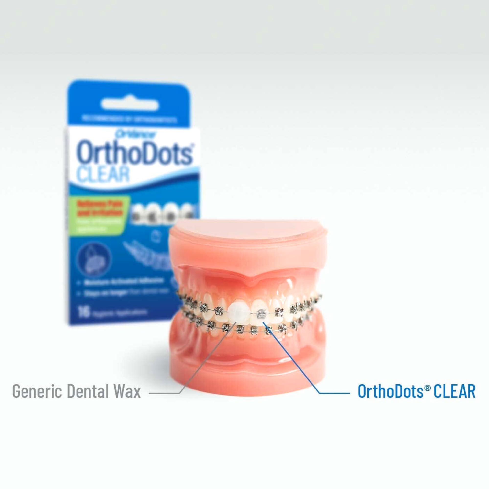 Orvance OrthoDots Clear stay put during meals for up to 24 hours.