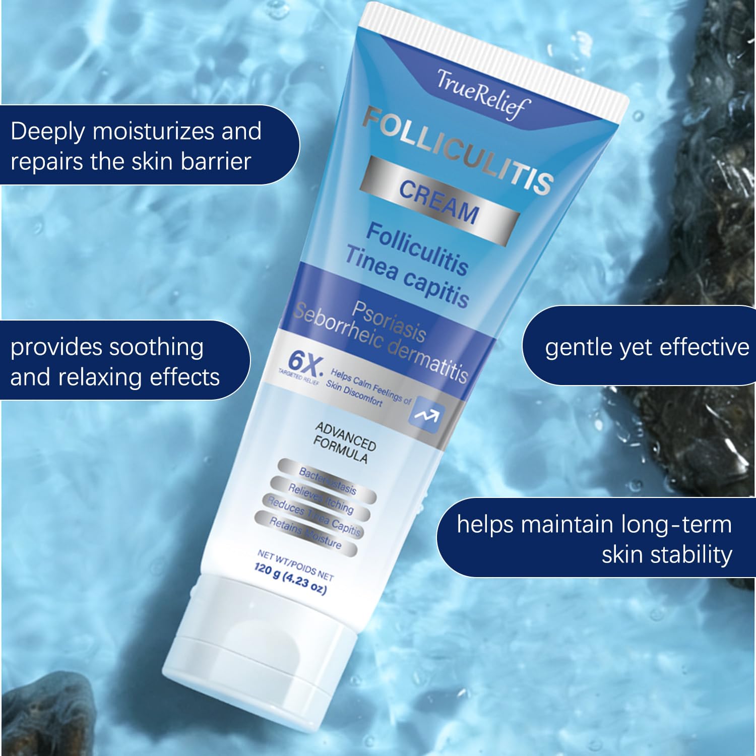 OUHENGTEK Folliculitis Cream on face supports smooth skin