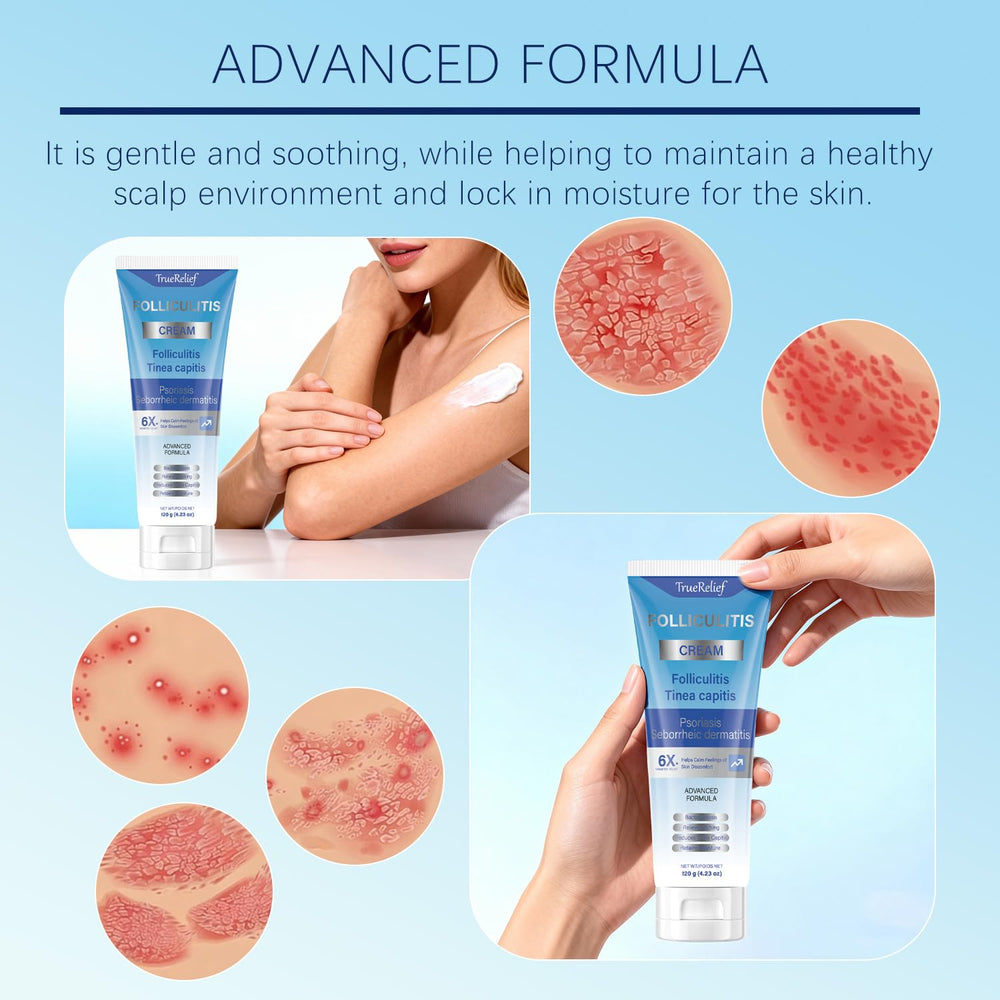 OUHENGTEK Folliculitis Cream two-pack packaging supports ongoing routine