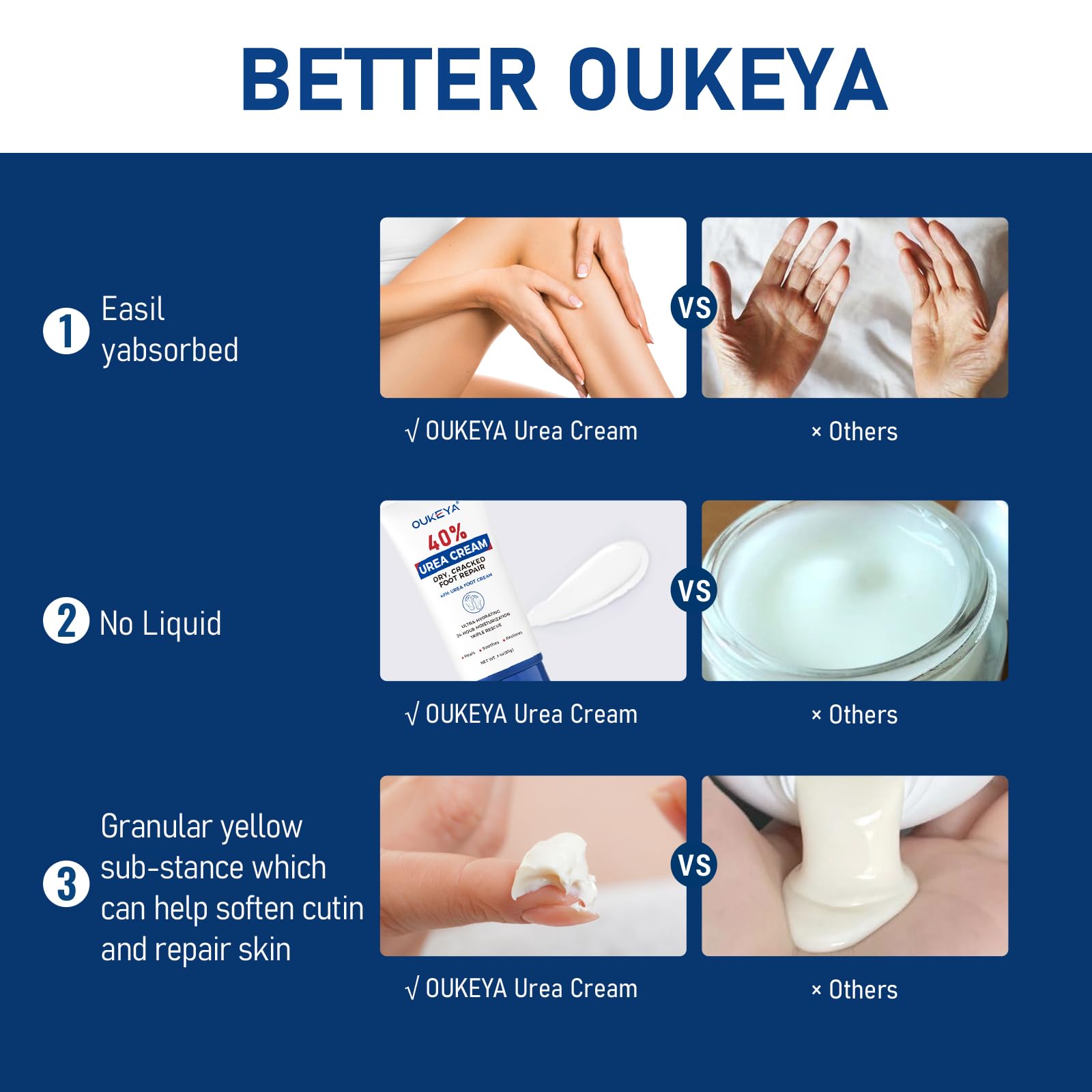 OUKEYA Urea Cream texture close-up showing creamy, non-greasy finish
