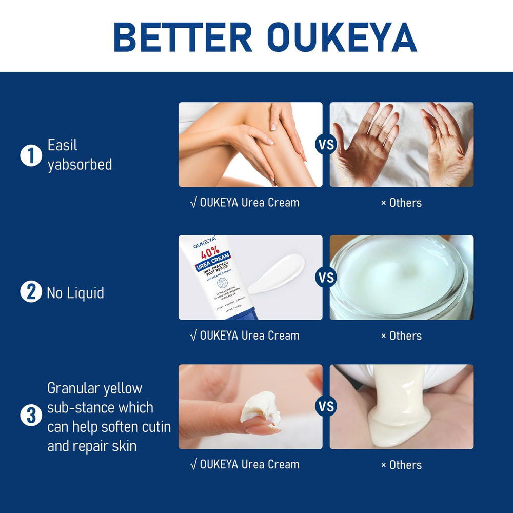 OUKEYA Urea Cream texture close-up showing creamy, non-greasy finish
