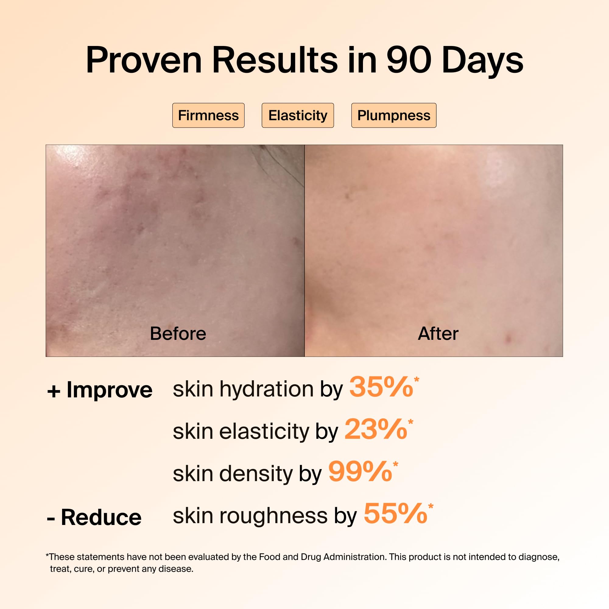 Ownist hydrolyzed marine collagen peptides enable fast dermis nourishment.