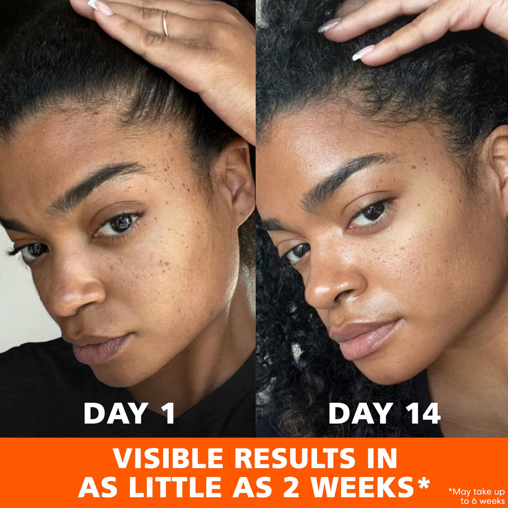 Palmer's Skin Success for all skin types suits daily routine.
