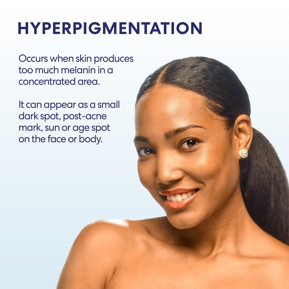 Palmer's anti-dark-spot cream on the face showing even-toning potential.